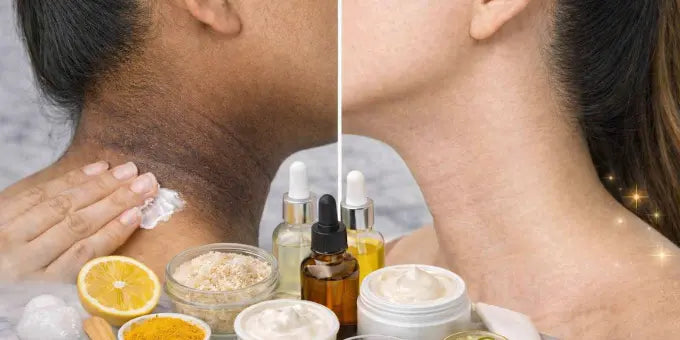 How to Treat Dark Neck? Its Causes and Treatment