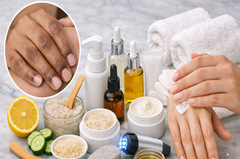 How to Treat Dark Knuckles: The Best Steps You Should Follow
