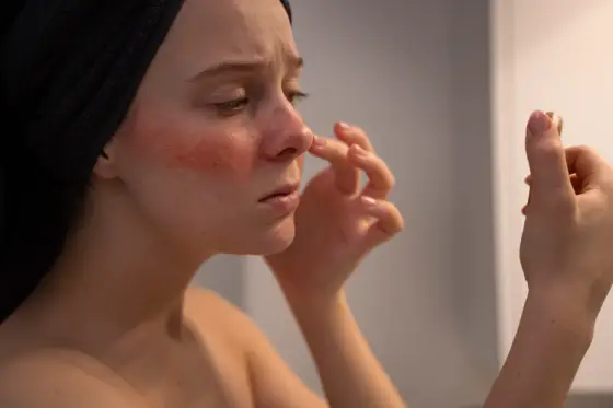 Causes and Prevention of Dry and Rough Skin Patches