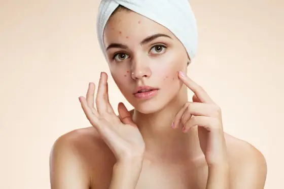 Common Skincare Routine to Treat Teens' Skin Problems