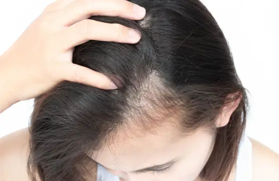 Discover the Unknown Secrets of Hair Loss