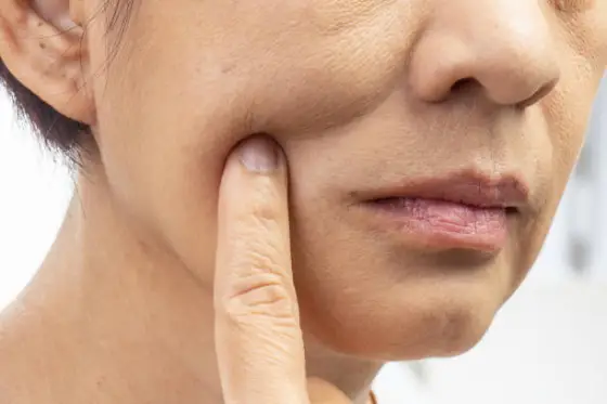 Sagging Skin: Know Its Causes, Cures, and Prevention