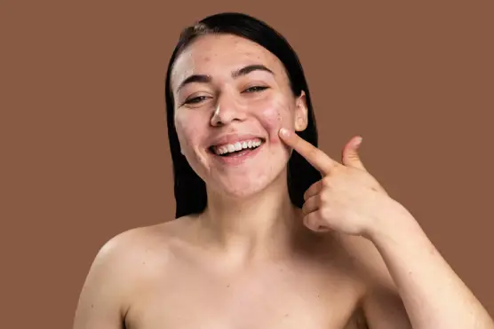 What Is Pigmentation? Know Its Types, Reasons, and Treatments